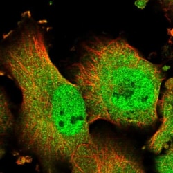 MDM1 Antibody, Novus Biologicals:Antibodies:Primary Antibodies